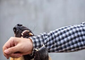 How Hammers Car Accident & Personal Injury Lawyers Can Help After a Dog Bite in Sandy Springs, GA